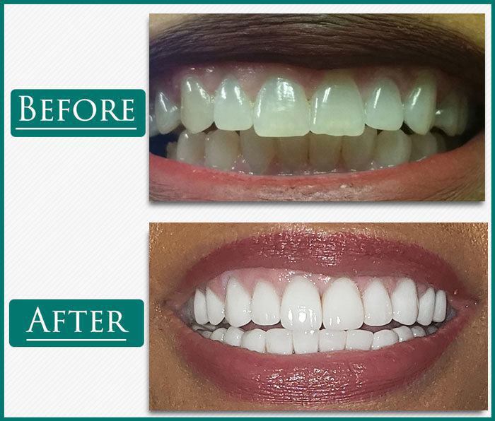 Frisco Dental News