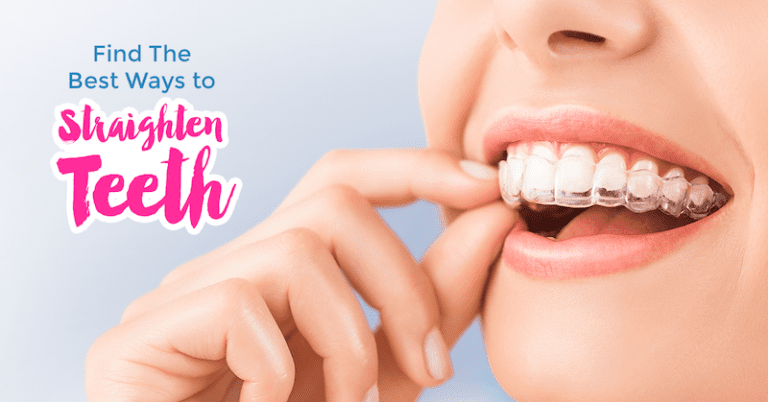 Invisalign