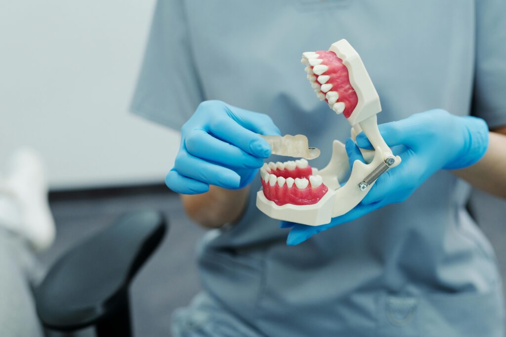 Close-up of a dental implant model demonstrating how All-on-4 supports a full set of teeth
